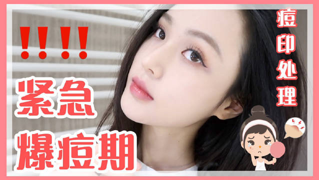 木木|宅家爆痘期 痘印紧急处理dei